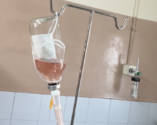 hydrogen infusion iaos